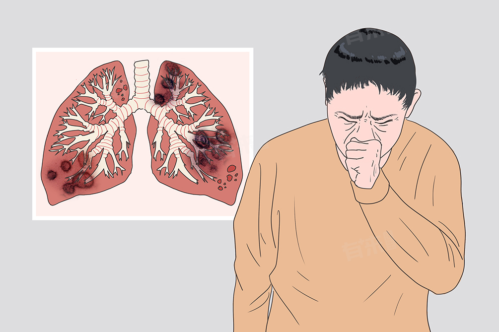 新型冠狀病毒感染的傳播途徑及預(yù)防措施，含疫情傳播方式介紹