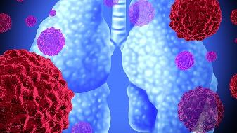 新冠疫情全球肆虐，群體免疫存爭議，我國初步控制國外嚴重